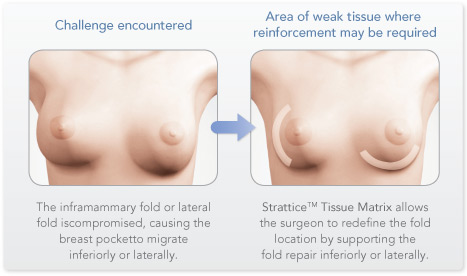 implantmal1