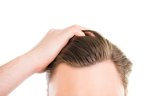 Get Your Hair Back! Non-Surgical Hair Loss Treatment - Restora Austin