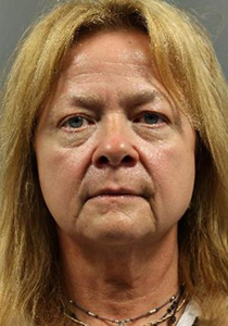 Patient before FaceLift at Restora Austin Plastic Surgery Centre in Austin, TX