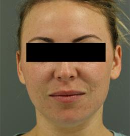 fillers-and-toxins-austin-tx