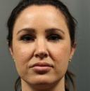 fillers-and-toxins-austin-tx