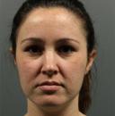 fillers-and-toxins-austin-tx