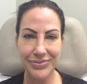 fillers-and-toxins-austin-tx